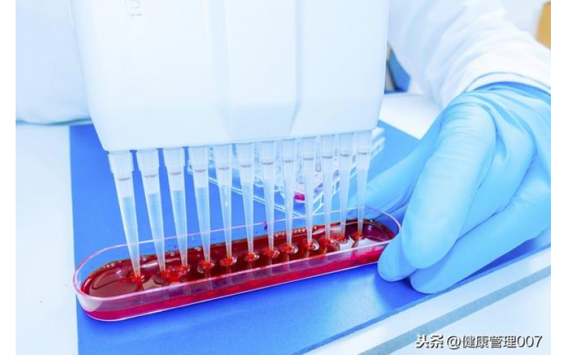 上?？諝鈾z測(cè)項(xiàng)目清單及費(fèi)用